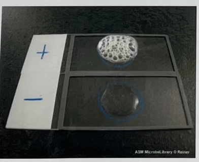 <p><strong>2 H2O2 —————-(Catalase)———> 2H2O + O2</strong></p><p>Catalase is an enzyme that breaks down hydrogen peroxide into water and oxygen. The presence of oxygen bubbles indicates a positive result. This test must be conducted using specimens from a plate or slant, and not from a broth</p><p></p>