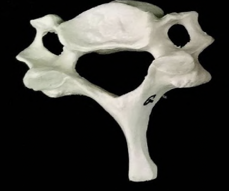 <p>what vertebrae is this?</p>