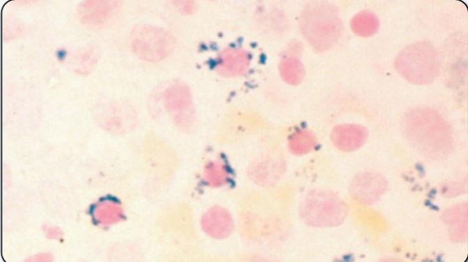 <p>What is the name for these iron-containing RBC precursors?</p>