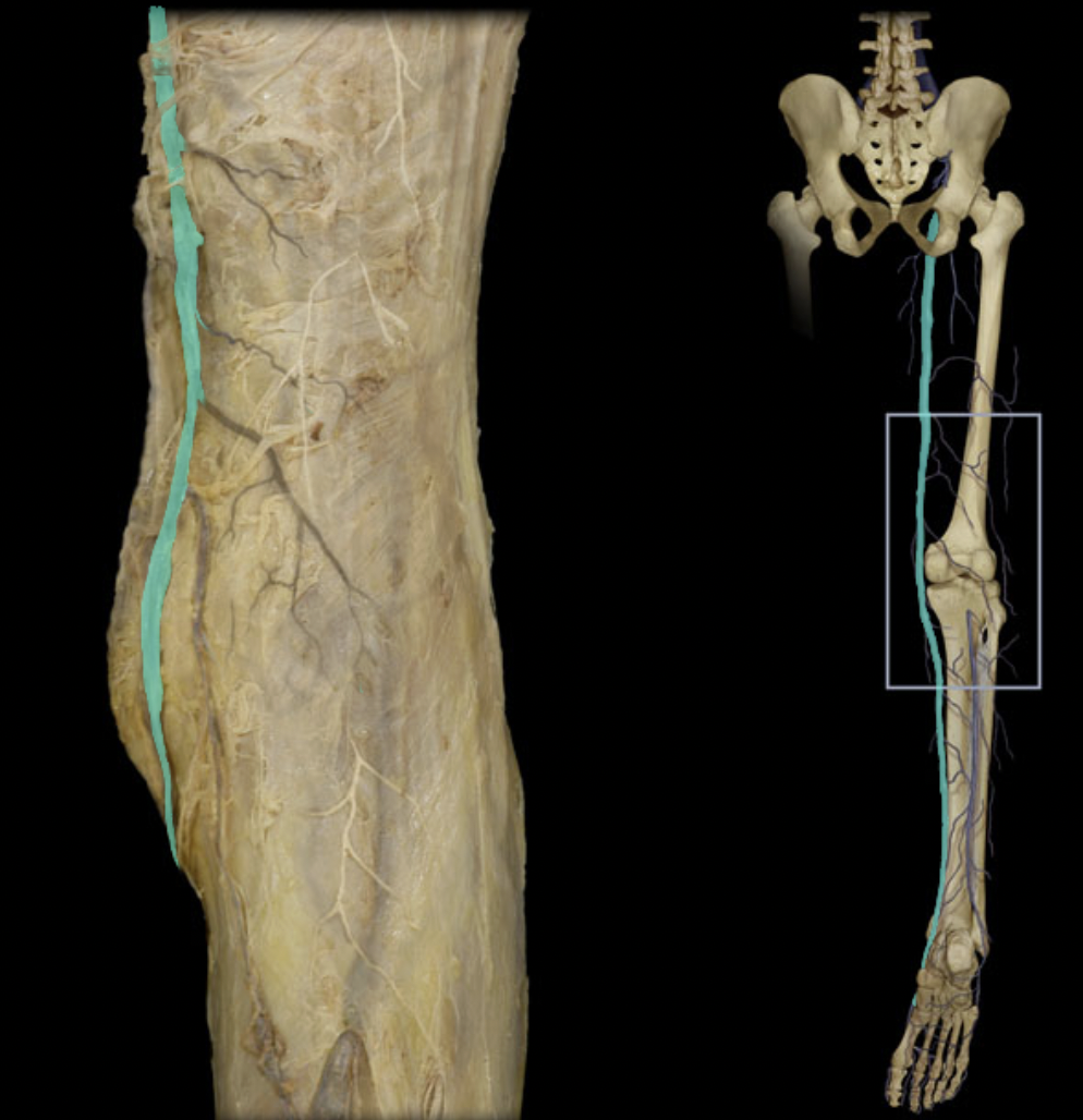 <p>Identify the blood vessel of the lower extremity</p>