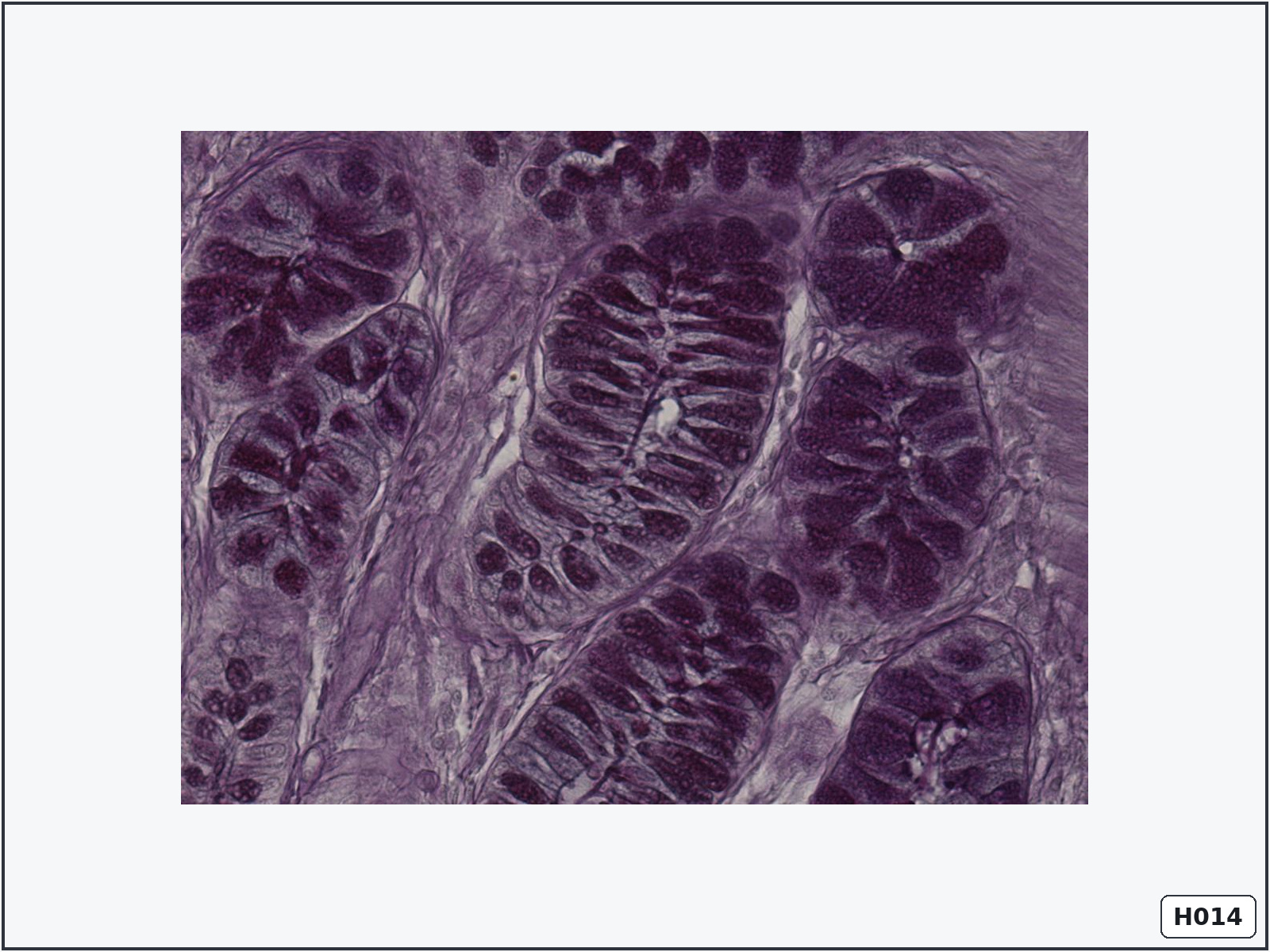 term image