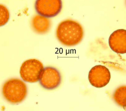 <p>Identify the pollen grains to the <strong>Family </strong>level</p>