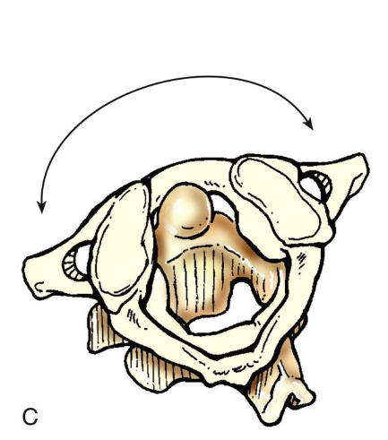 <p>Pivot joint</p>