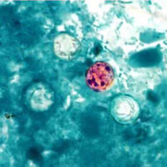 <p><span>10&nbsp;<strong>µm </strong></span><span style="background-color: transparent; font-family: Arial, sans-serif, Inter, ui-sans-serif, system-ui, -apple-system, BlinkMacSystemFont, "Segoe UI", Roboto, "Helvetica Neue", "Noto Sans", "Apple Color Emoji", "Segoe UI Emoji", "Segoe UI Symbol", "Noto Color Emoji"; font-size: 1.6rem;">Modified acid-fast stain</span></p>