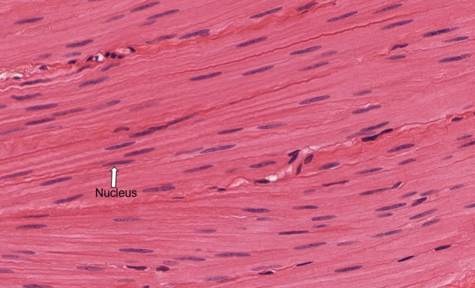 <p>What kind of Muscle is this</p>