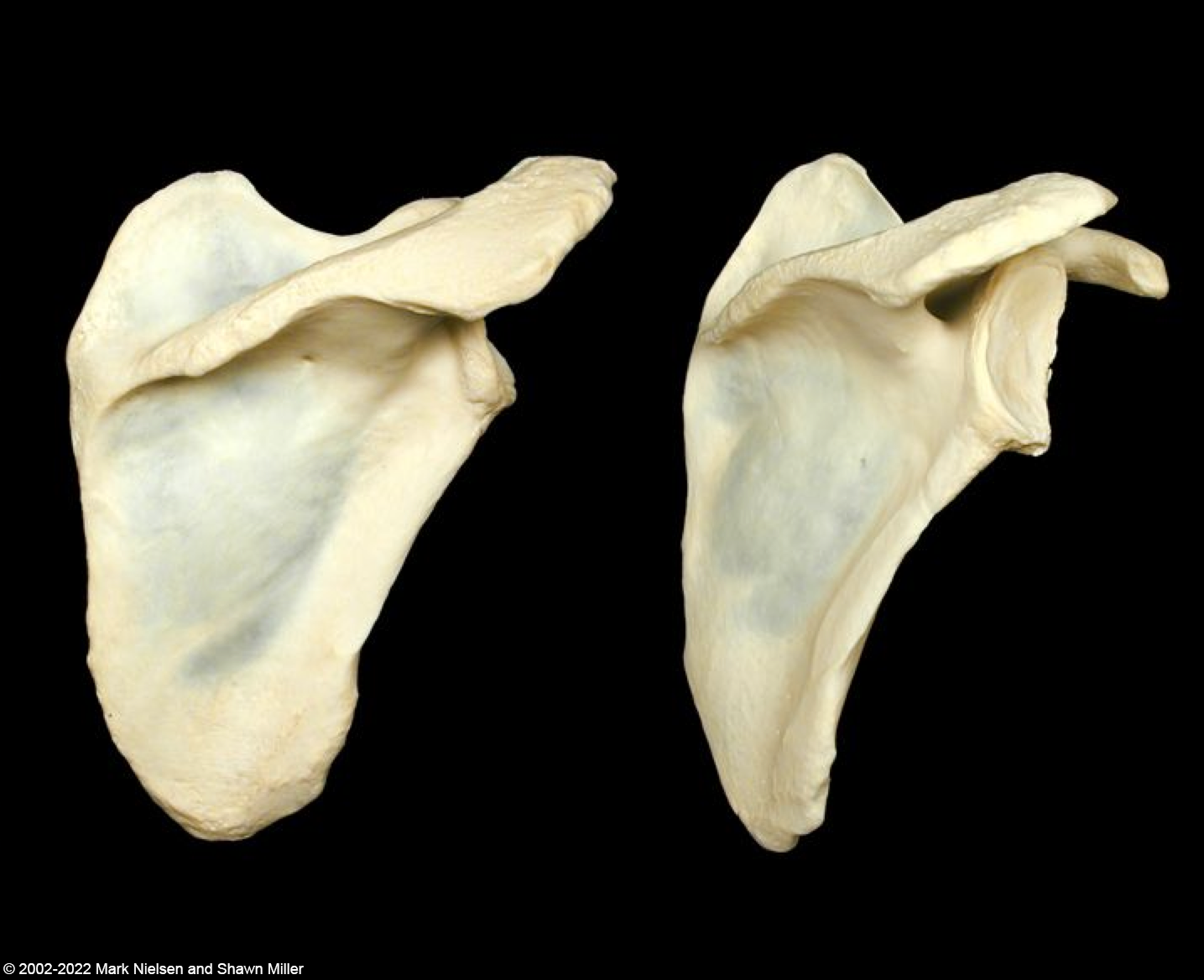<p><span style="background-color: transparent; font-family: "Times New Roman", serif;">On Scapula: Acromion, Spine of scapula</span></p>