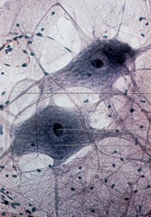 <p>specialized nerve cell for sending messages all over the body</p>