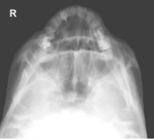 <p><span style="background-color: transparent;">Facial - SMV</span></p>