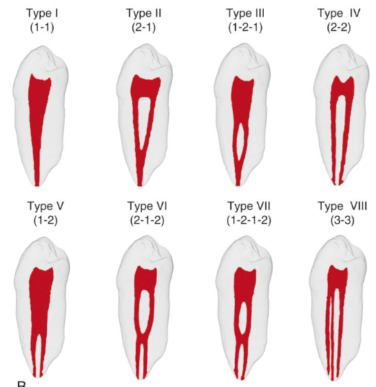 <p>What is the difference between Weine and Vertucci’s classification?</p>