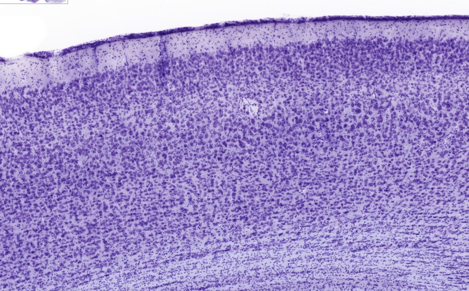 <p>Identifica la plaquita</p>