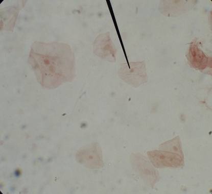 <p>what cells? what at pointer?</p>