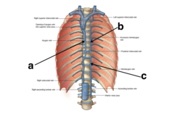 <p>- accessory hemiazygos (superior)</p><p>- hemiazygos (inferior)</p><p>- both under descending aorta</p>