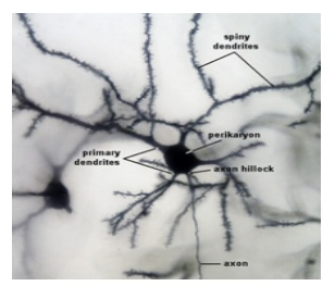 <p>Forebrain : Cortex Golgi/ Multipolar Neuron : Function : Transmits nerve impulses over long distances between the brain, spinal cord, and other parts of the body.</p>