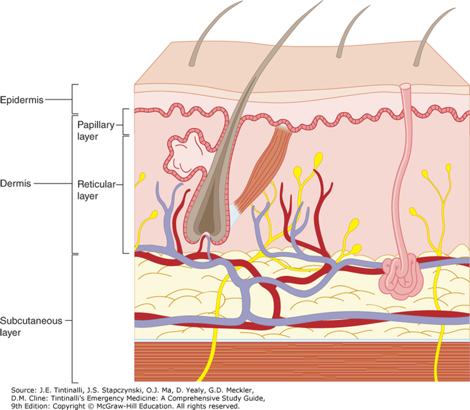 <ul><li><p>Depth and severity vary by both age of victim and anatomic locations exposed</p></li><li><p>Partial thickness burns disrupt skin barrier → free water loss</p><ul><li><p>Becomes significant in moderate to large burns</p></li></ul></li><li><p>Result: spectrum of local and systemic homeostatic disorders contributing to burn shock</p></li><li><p>Fluid and electrolyte abnormalities seen in burn shock due to alterations in cell membrane potential</p><ul><li><p>Intracellular influx of water and sodium</p></li><li><p>Extracellular migration of potassium due to dysfunction with sodium pump</p></li></ul></li><li><p>Systemic vascular resistance increased due to inflammatory response of the burn </p></li><li><p>Significant metabolic acidosis may be present early in large burn injuries</p></li><li><p>Massive burns increase blood viscosity in early phases → transition to anemia from erythrocyte extravasation and destruction</p></li><li><p>Cellular damage occurs at temperatures > 45 degrees Celsius → denaturation of cellular proteins </p></li><li><p>Most important factors </p><ul><li><p>Severity of the burn </p></li><li><p>Presence of inhalation injury </p></li><li><p>Associated injuries </p></li><li><p>Patient’s age and comorbid conditions </p></li><li><p>Acute organ system failure </p></li></ul></li></ul><p></p>