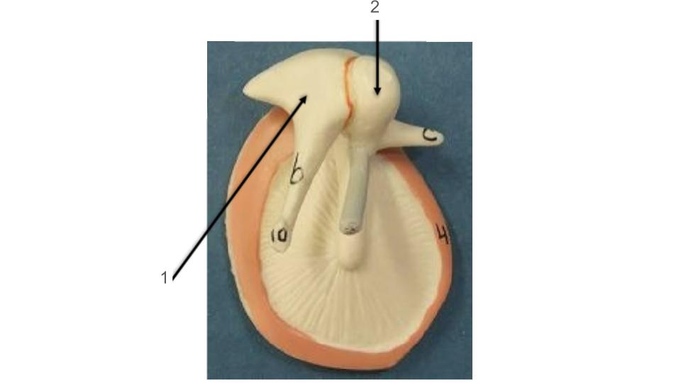 <p>2, bone</p>