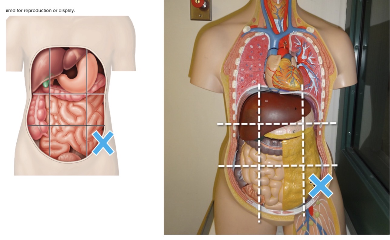 <p>Name the abdominopelvic region the mark is in</p>