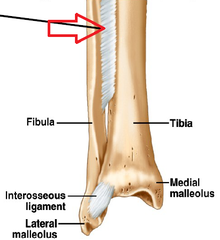 <p>minimal twisting/stretching motion (ex. tibia/fibula)</p>