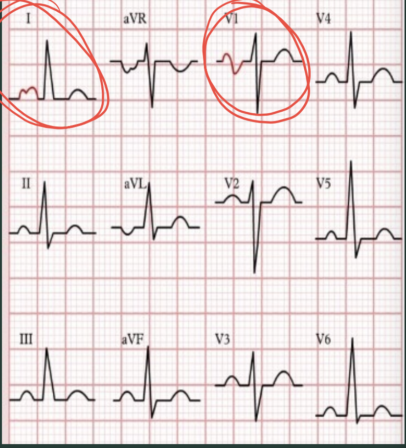 <p>What type of hypertrophy is this?</p>