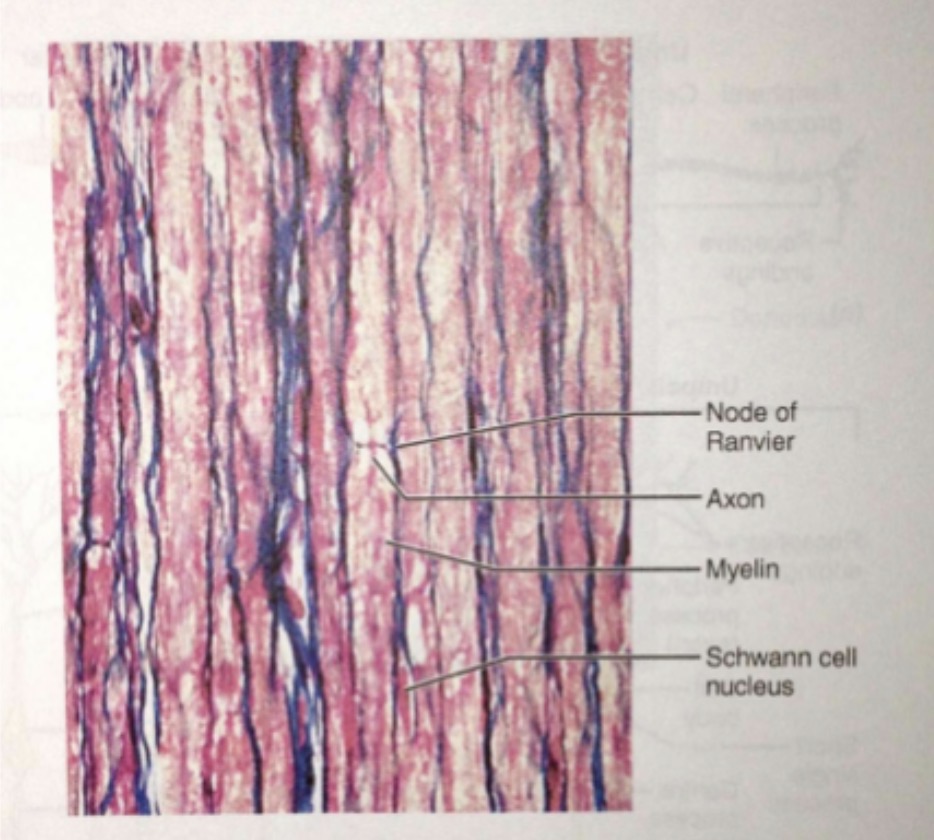 <p>Peripheral Nervous Tissue </p>