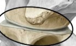 <p>Synovial: articular surfaces of hyaline cartilage,</p><ul><li><p><span style="color: rgb(235, 47, 209);"><strong>enclosed by a capsule with synovial fluid</strong></span>;</p></li><li><p>a single level <span style="color: rgb(88, 253, 255);"><strong>glides little</strong></span>,</p></li><li><p>but ~30 levels together give the column its range.</p></li></ul><p></p>