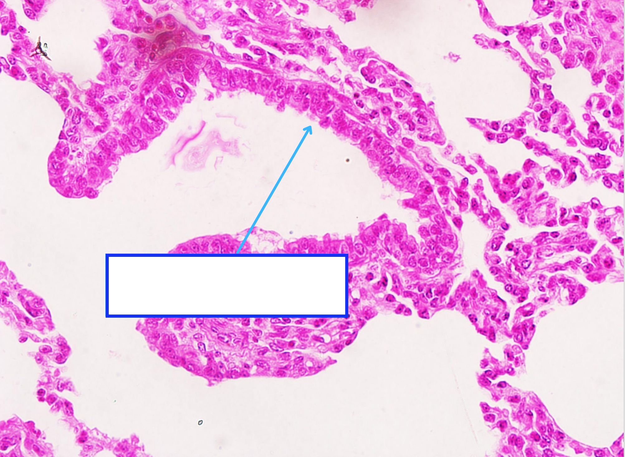 <p>Cấu trúc gì ?</p>