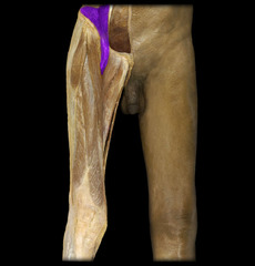 <p>identify the structure</p>