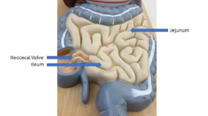<p>jejunum, ileum, ileocecal valve</p>