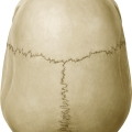 <p>The "skull cap" (structure)</p>