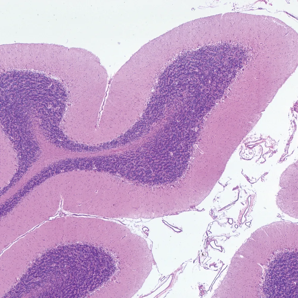 <p>Distinct dendritic pattern, near 4th ventricle and choroid plexus</p>