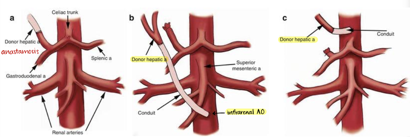 <p>why is a conduit used in B and C?</p>