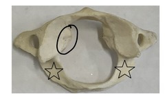 <p>what is marked? (not the star)</p>