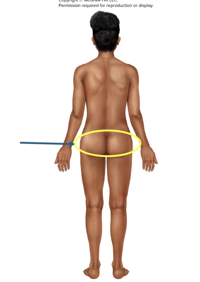 <p>Name the body part or region</p>