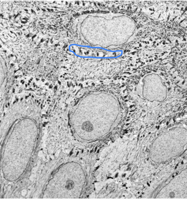 <p>Identify the blue circles</p>