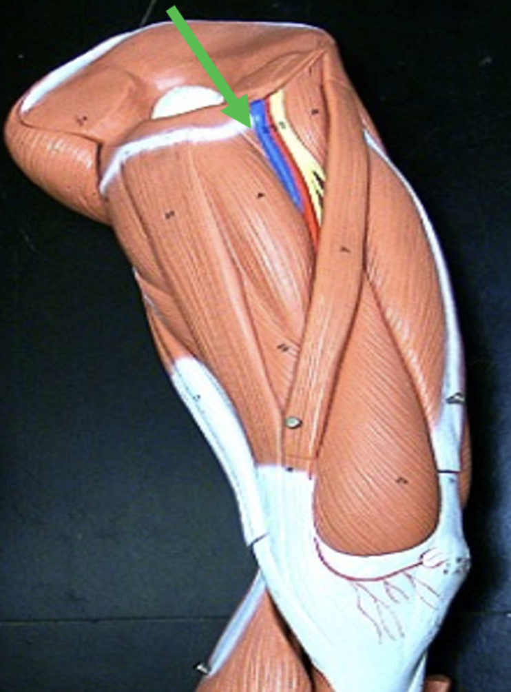 <p>Identify the muscle indicated by the pointer.</p>