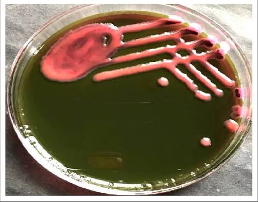<p><strong>Colorless</strong>, transparent, or light amber colonies</p><p></p><p>No fermentation occurs. The colonies do not lower the pH to absorb the dyes.</p>