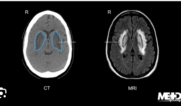 <p>Name this part of the brain</p>