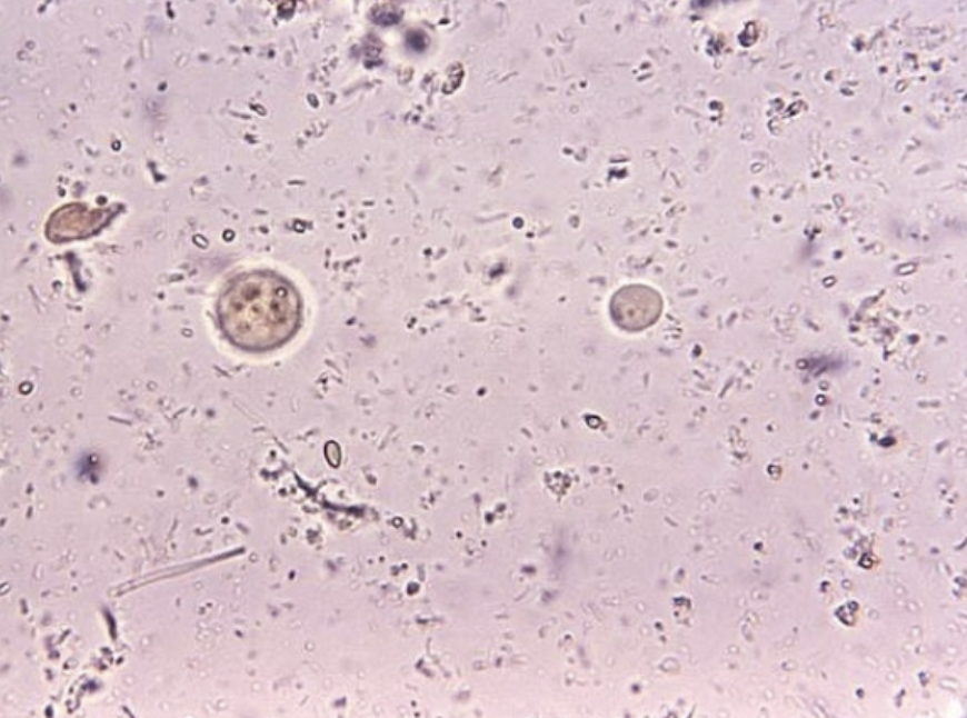 <p>What is this protist? (genus name)</p>