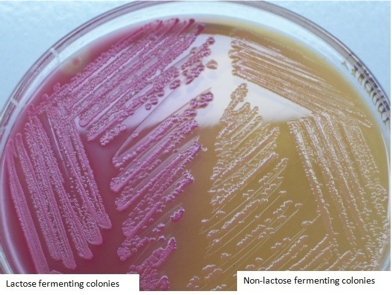 <p>explain the picture using technical terms</p><ol><li><p>what this showing (what type of agar)</p></li><li><p>explain whats happening on the right and what it can be </p></li><li><p>explain what’s happening on the left and what it can be </p></li></ol><p></p>