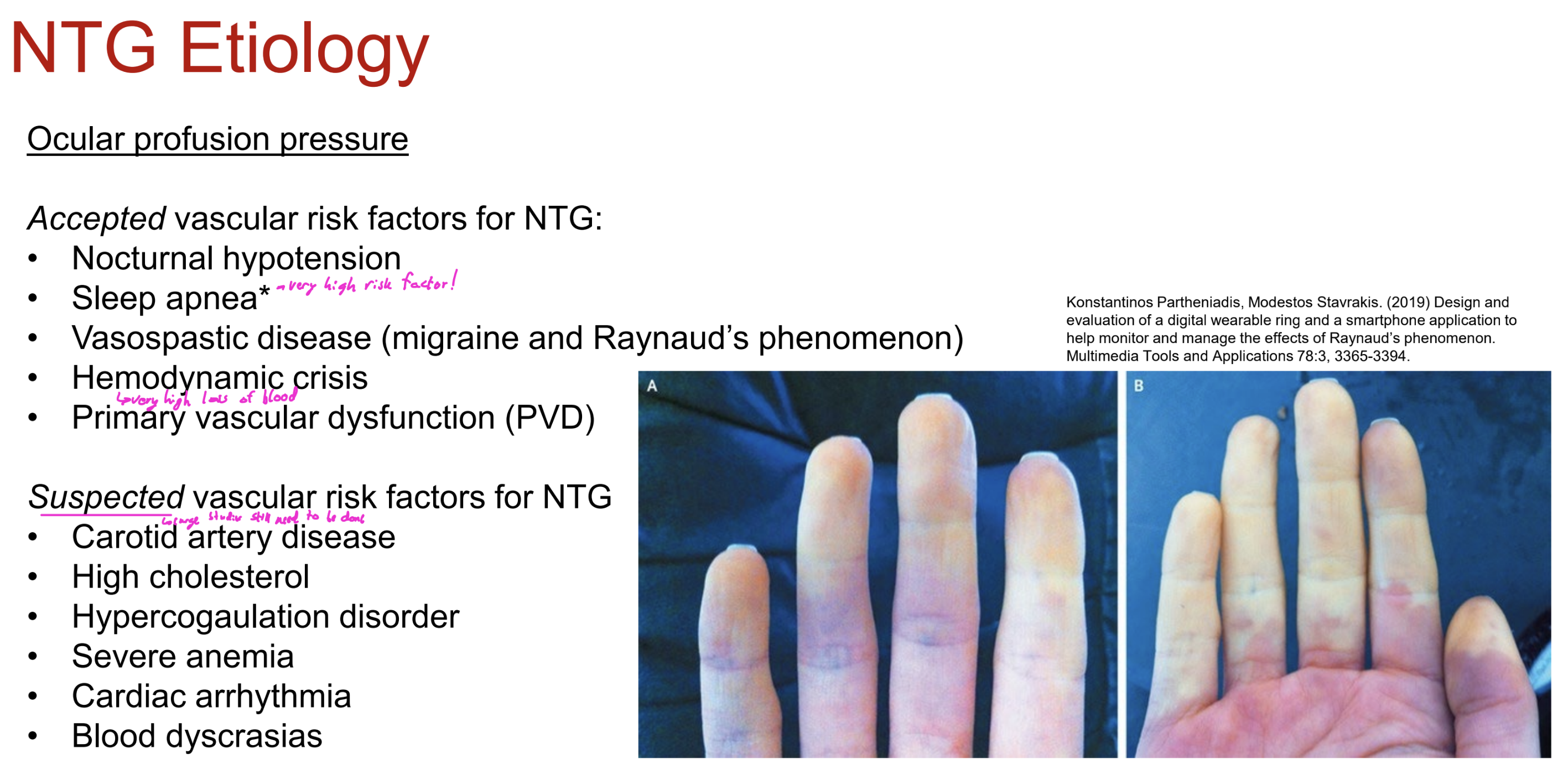 <p>What are the SUSPECTED vascular risk factors for NTG?</p>