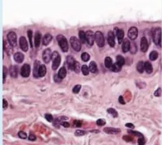 <p><strong>stratified columnar</strong>: location</p>