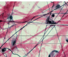 <p>what tissue</p>