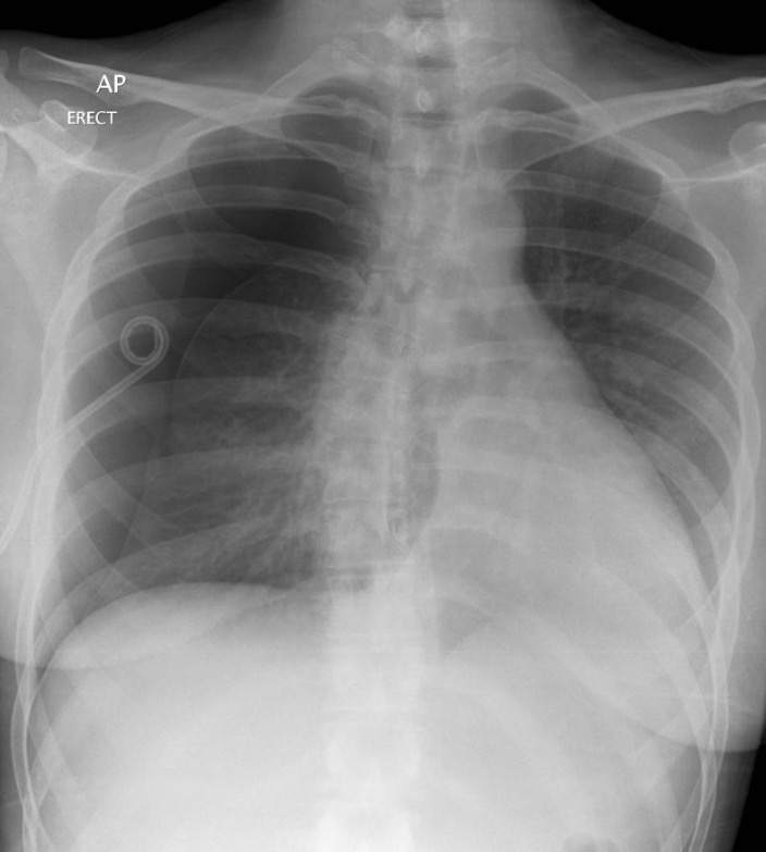 <p>25-year-old female with no background available</p>