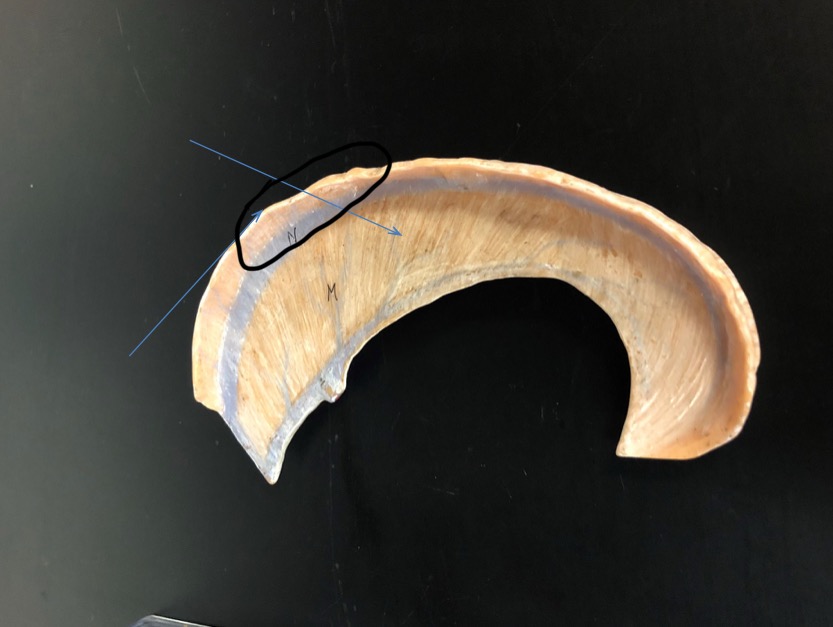 <p>Identify the circled area?</p>