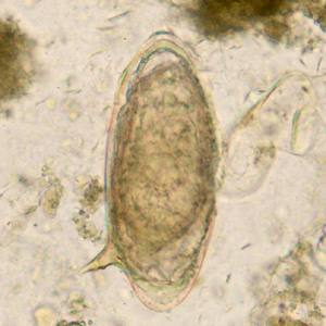 <p>Schistosoma species with callout bubble egg?</p>