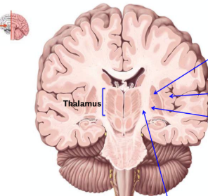 <p>Label this coronal anterior section of the brain </p>