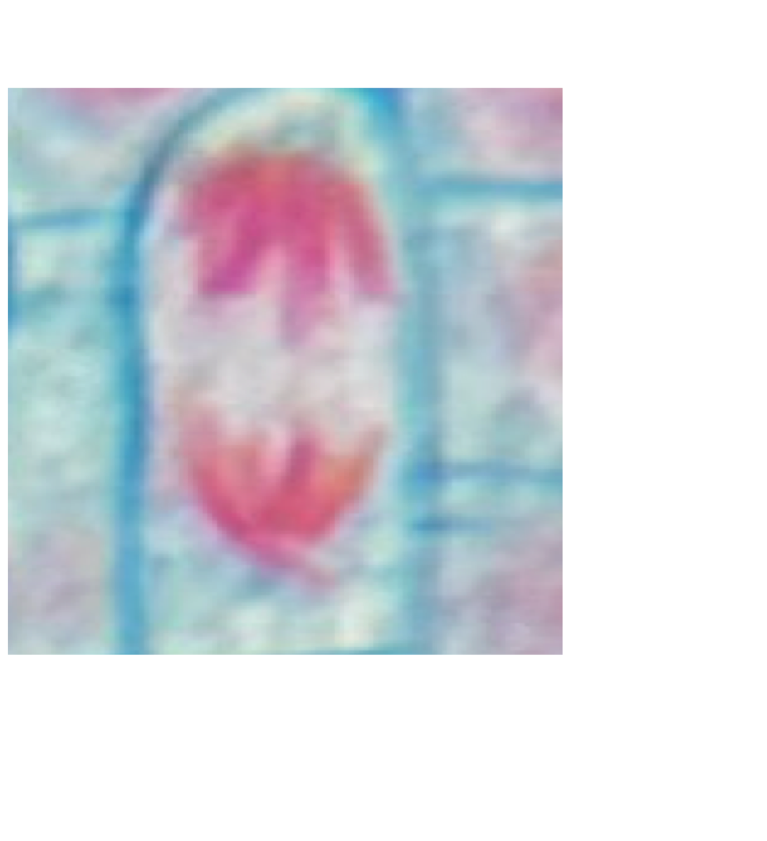 <p>What phase of mitosis is this?</p>