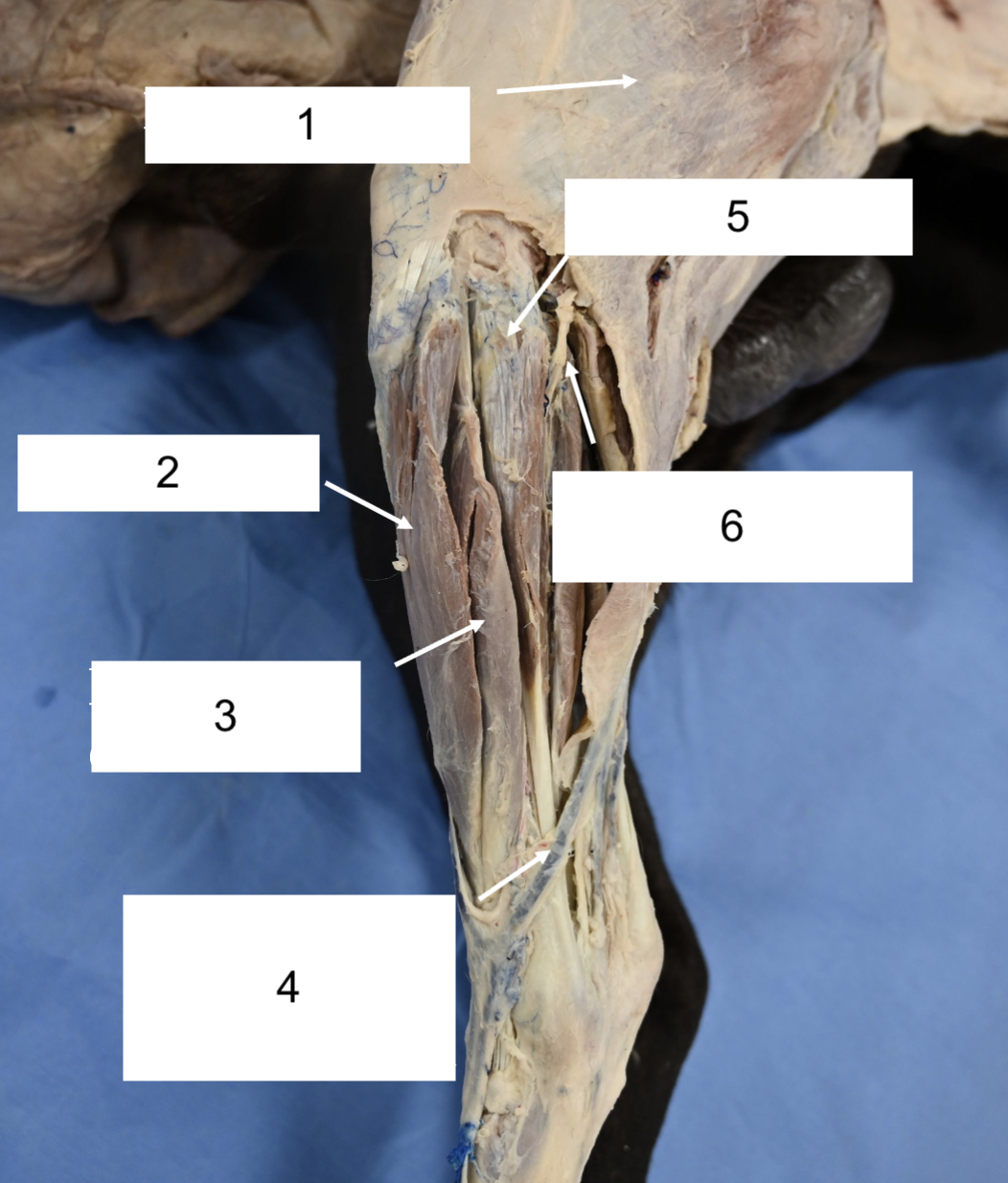<p>What nerve is 6?</p>