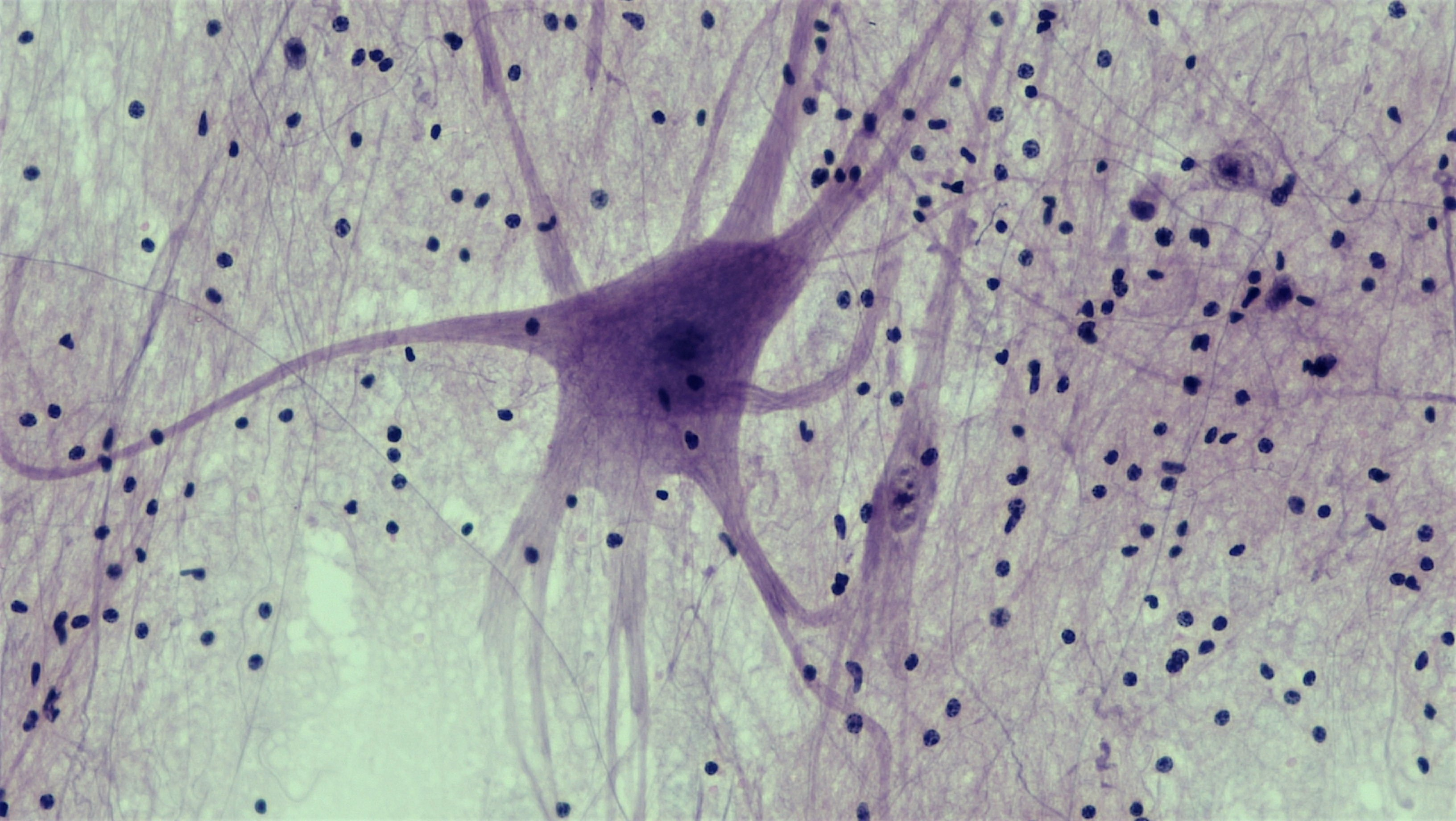 <p>is located in the brain, spinal cord, and nerves</p>