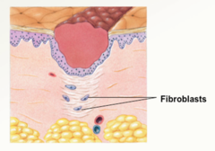 <p>Occurs 12 hours-10 days; involves macrophages, fibroblasts, endothelial cells, and smooth muscle cells.</p><p>(Explanation: Macrophages remove debris, fibroblasts produce collagen, endothelial cells form new blood vessels, and smooth muscle cells support vascular structure, creating granulation tissue as a foundation for repair.)</p>