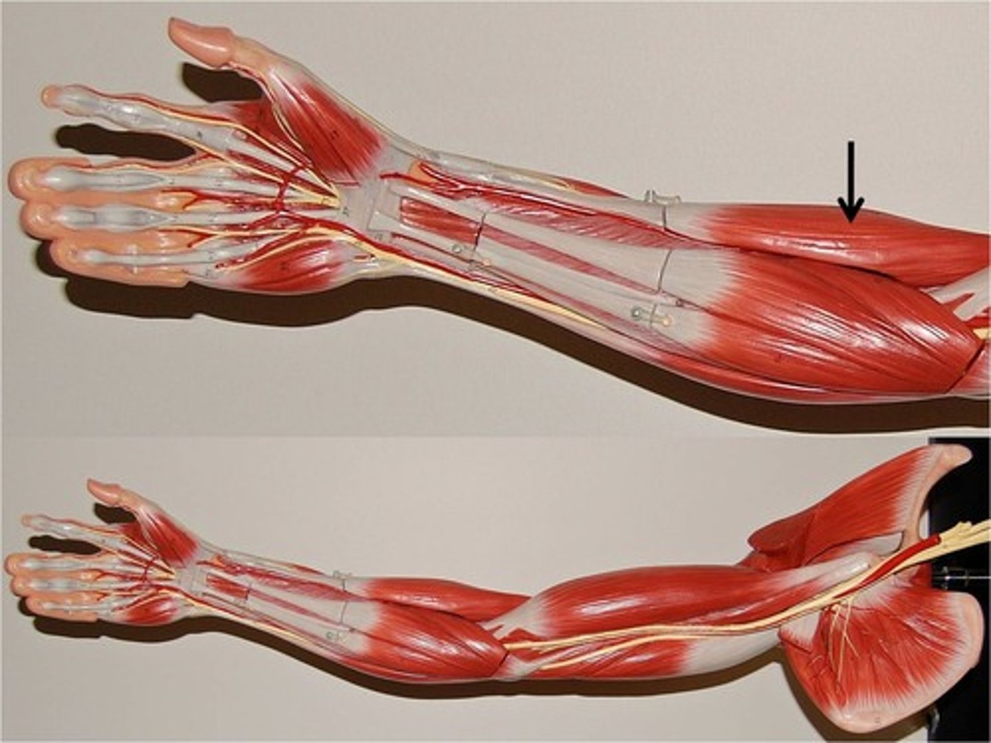 <p>Action - flexes the arm at the elbow</p>